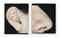 Ear and Nose: Right Side (Analia)  