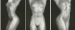 Lydia, 1985  