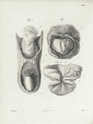 BAILLIE, Matthew. A Series of Engravings, accompanied with Explanations...