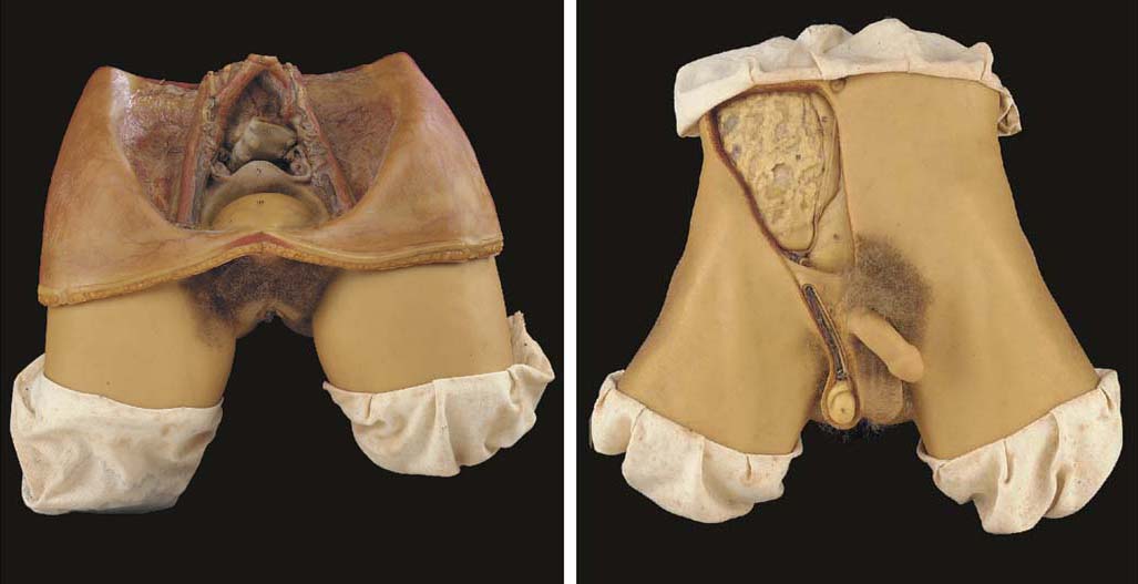 Male and female sterilisation | Christie's