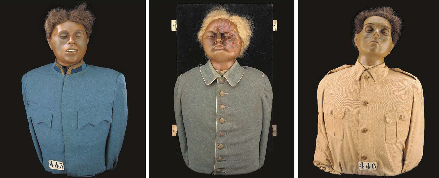 Phosgene Gas Effects