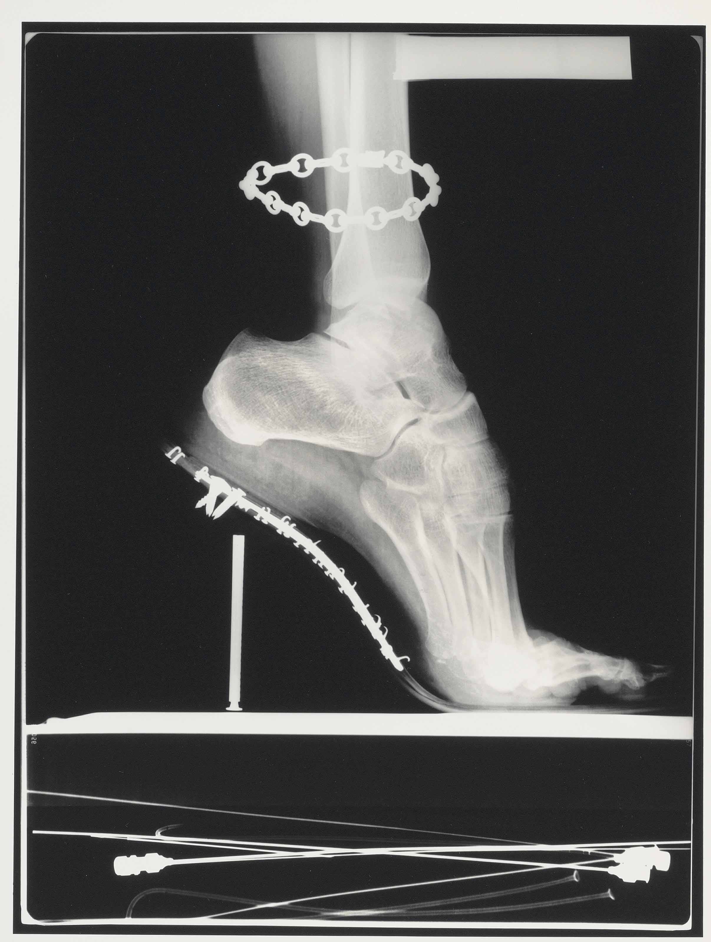 Helmut Newton 1920 2004 X Ray French Vogue Paris 1994 Photographs Germany Christie S