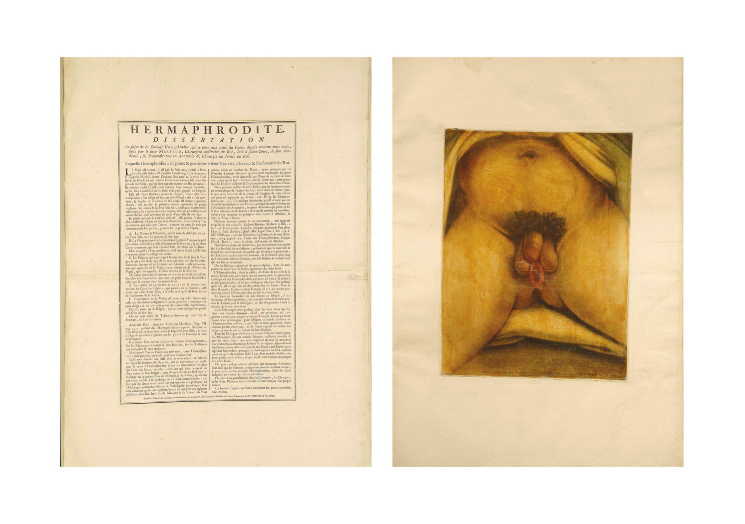 What is a dissertation image