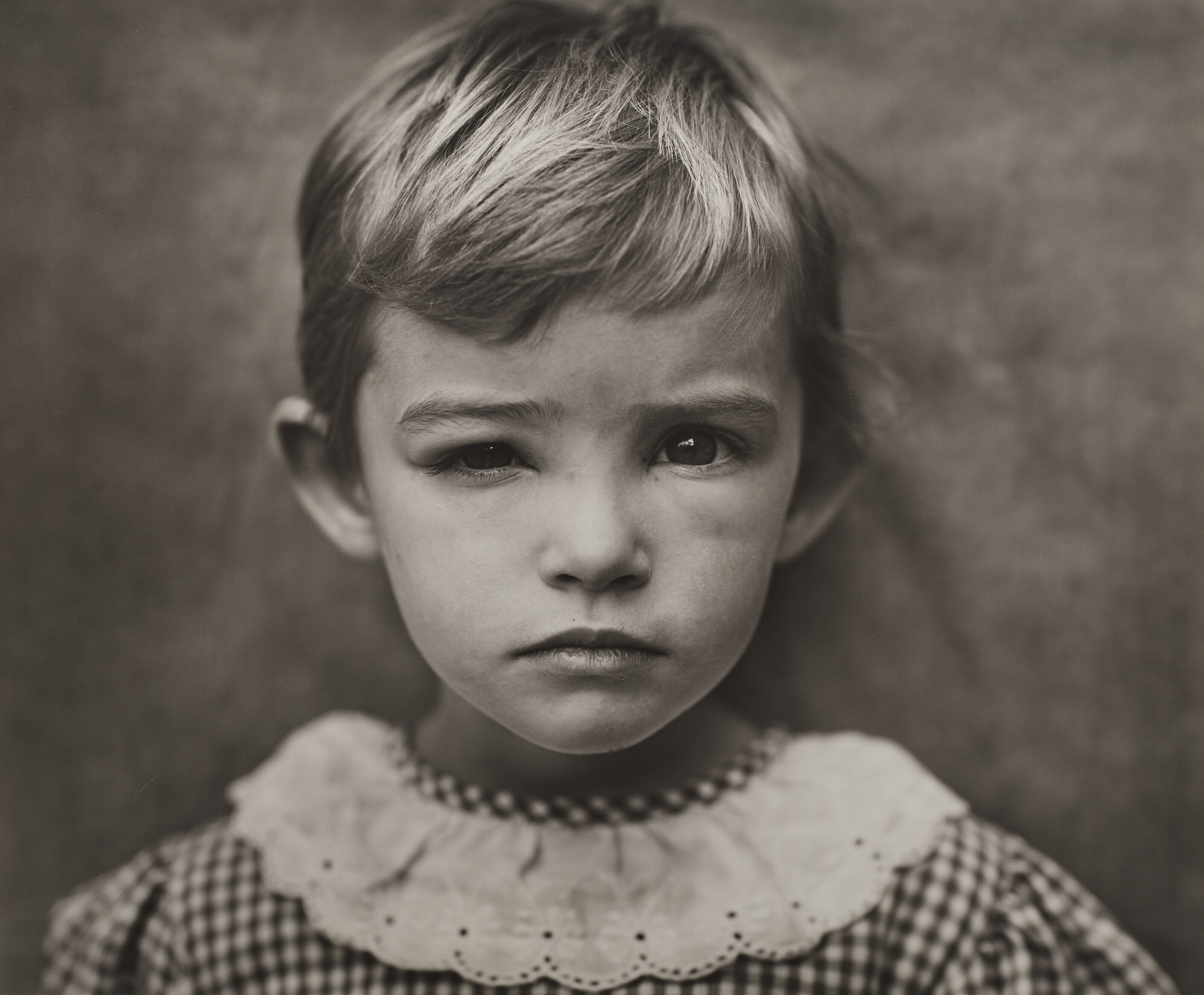 SALLY MANN (B. 1951), Damaged Child, 1989 | Christie's