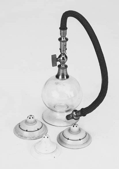 A 19th-Century breast aspirator,