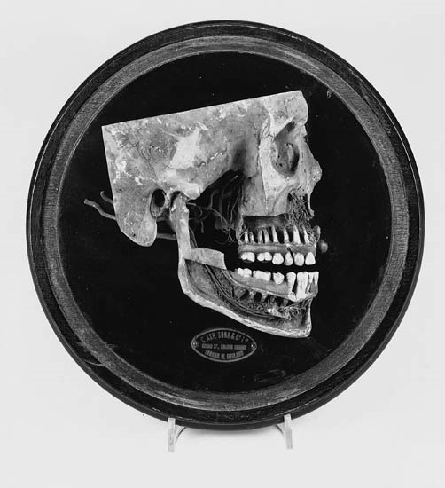 A part-sectioned model of the human skull,