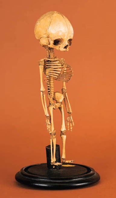A [?]late Victorian foetal skeleton