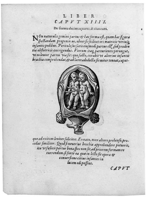 RUEFF, Jacob (1500-1558). De conceptu et generatione hominis: De matrice et eius partibus, nec non de conditione infantis in utero, et gravidarum cura et officio. Frankfurt: Sigismund Feyrabend for Georg Corvinus, 1580.