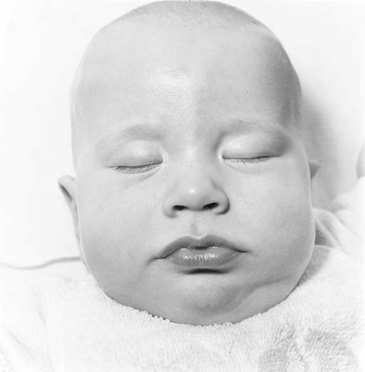 DIANE ARBUS (1923-1971)