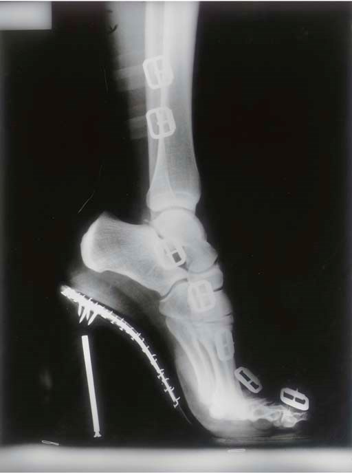 HELMUT NEWTON (1920-2004)
