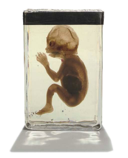 A fluid-preserved specimen of a human foetus,