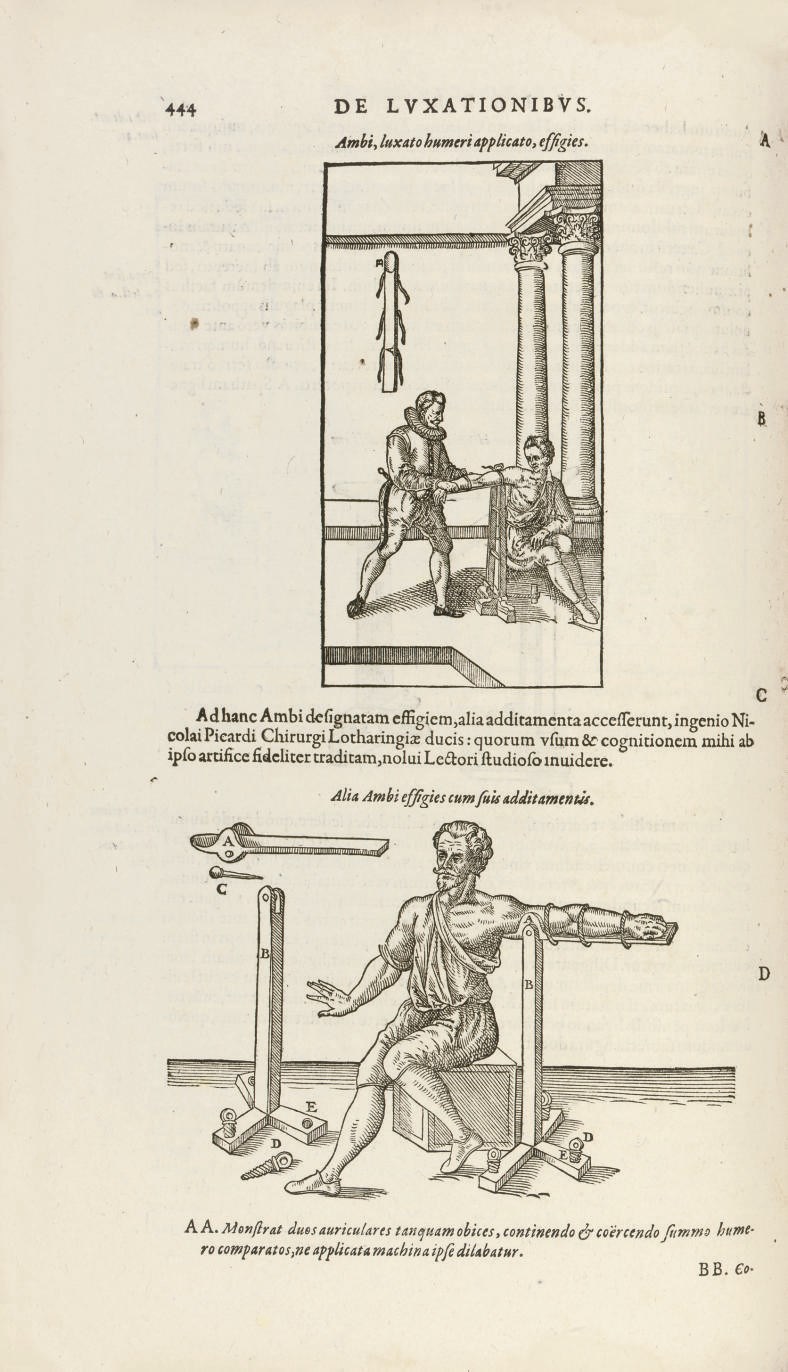 PARE, Ambroise (1510?-1590). Opera chirurgica. Frankfurt a.M.: J. Feyerabend for P. Fischer, 1594. 2° (336 x 210mm). Title printed in red and black with large woodcut device, another device at end, woodcut portraits of Paré, Hippocrates and Galen and numerous illustrations in the text (lacks the final blank, title rather stained and with repairs in the inner margin, a little occasional spotting and waterstaining, minor paper flaw in Gg1). Modern brown half niger morocco. Adams P314 (one imperfect copy); this edition not in Wellcome.