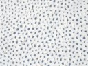 Yayoi Kusama (b. 1929)